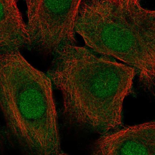 Cystatin A Antibody in Immunocytochemistry (ICC/IF)