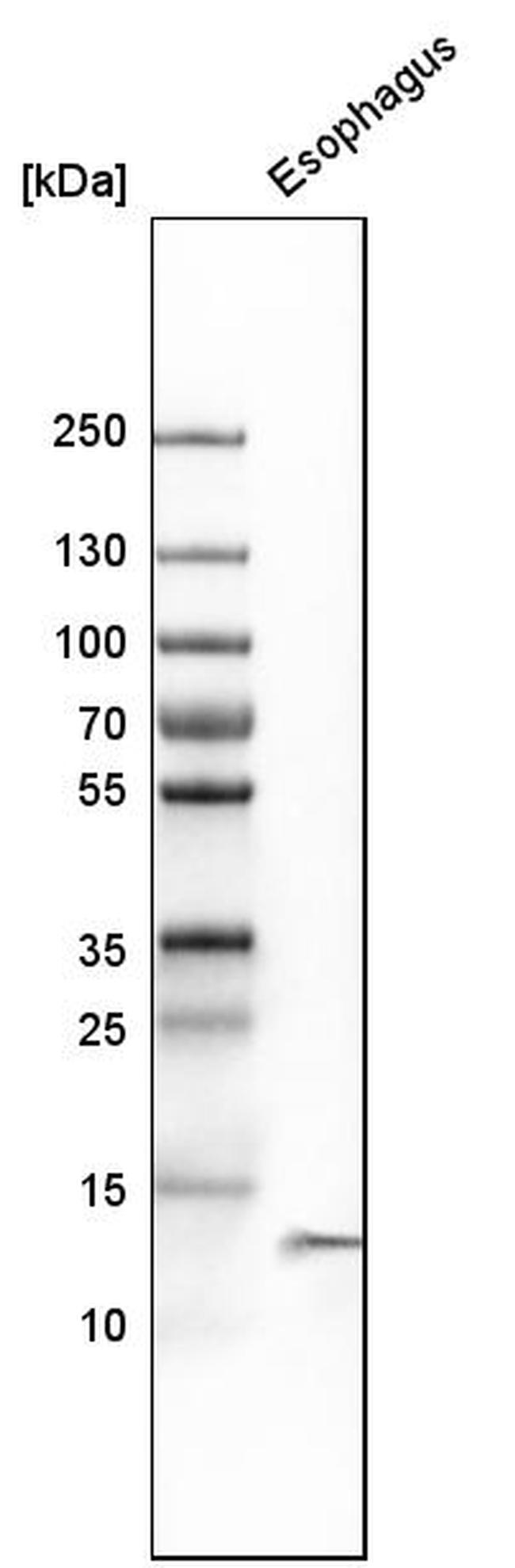 Cystatin A Antibody in Western Blot (WB)