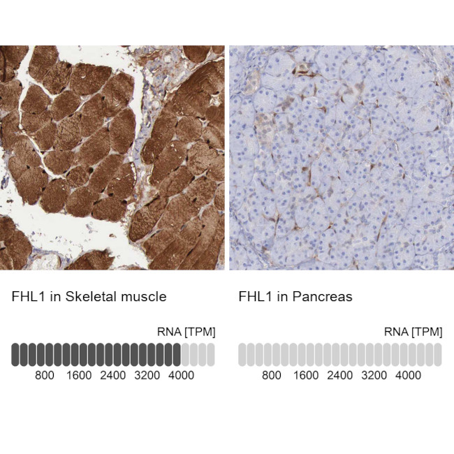 FHL1 Antibody in Immunohistochemistry (IHC)