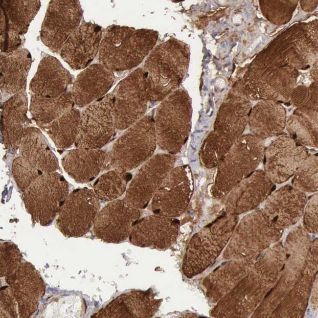 FHL1 Antibody in Immunohistochemistry (IHC)