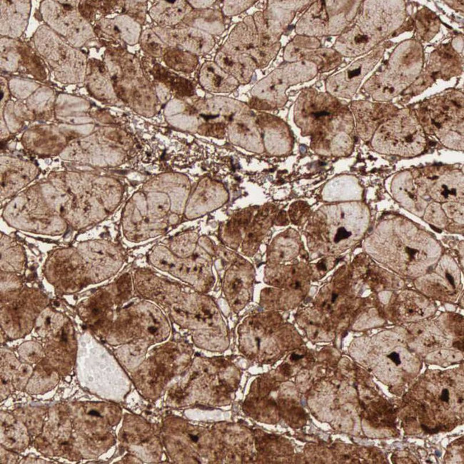 FHL1 Antibody in Immunohistochemistry (IHC)