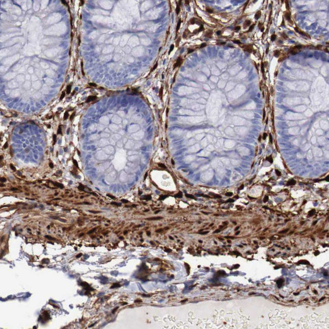 FHL1 Antibody in Immunohistochemistry (IHC)