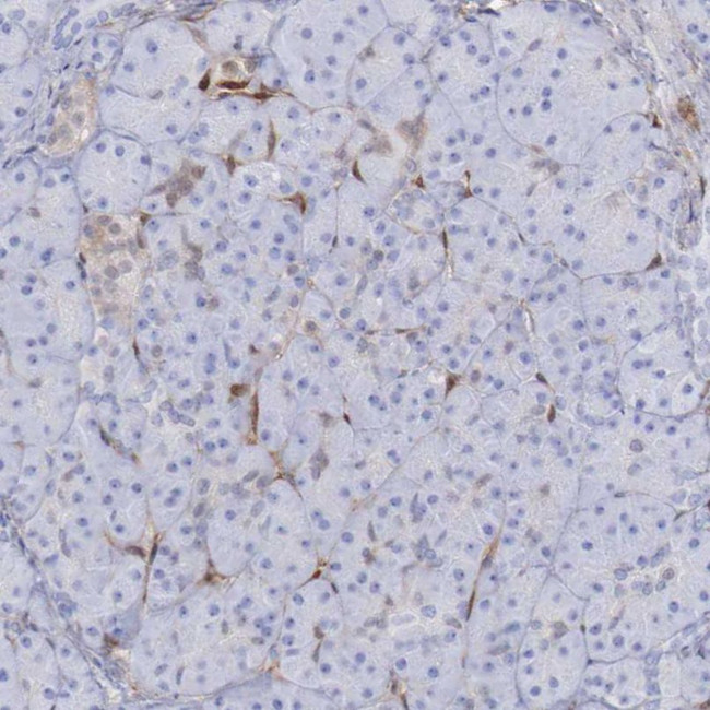 FHL1 Antibody in Immunohistochemistry (IHC)