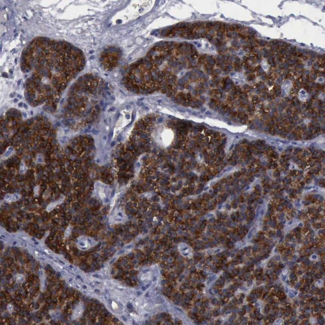 PHKA1 Antibody in Immunohistochemistry (IHC)