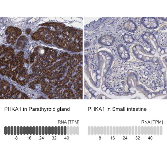 PHKA1 Antibody