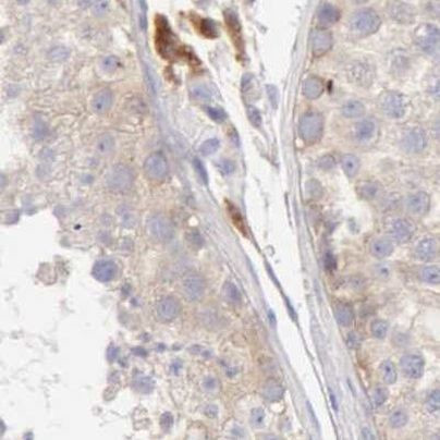 RhoGAP4 Antibody in Immunohistochemistry (IHC)