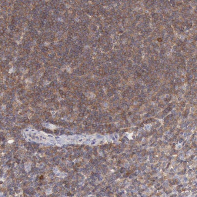 SASH3 Antibody in Immunohistochemistry (IHC)