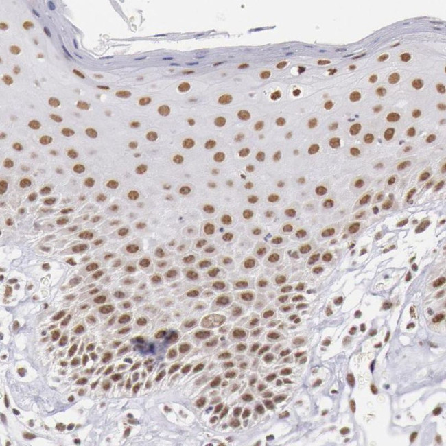 SNRPD3 Antibody in Immunohistochemistry (IHC)