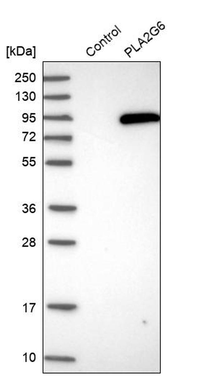 PLA2G6 Antibody in Western Blot (WB)