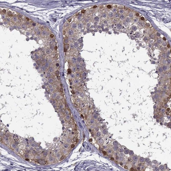 MAGEB1 Antibody in Immunohistochemistry (IHC)