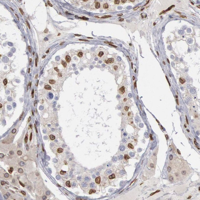 UNC84B Antibody in Immunohistochemistry (IHC)