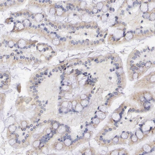 GAL3ST1 Antibody in Immunohistochemistry (IHC)