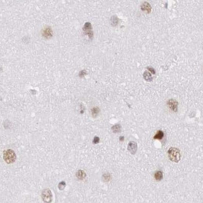 DGCR14 Antibody in Immunohistochemistry (IHC)