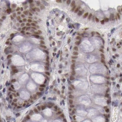 DGCR14 Antibody in Immunohistochemistry (IHC)