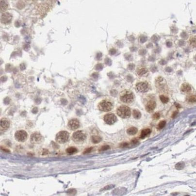 DGCR14 Antibody in Immunohistochemistry (IHC)