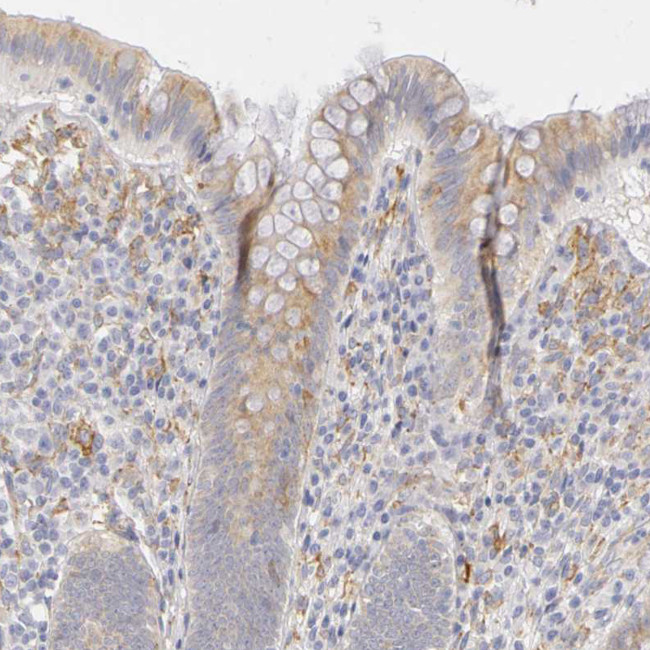 PLOD3 Antibody in Immunohistochemistry (IHC)