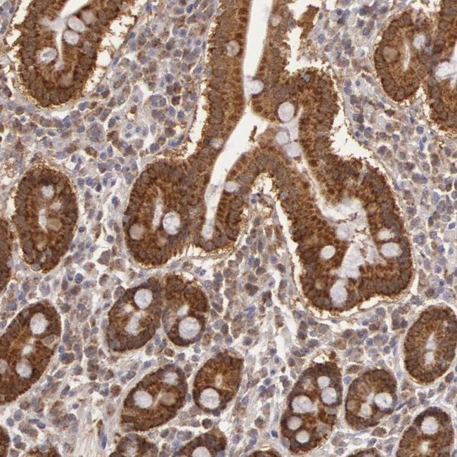 MPST Antibody in Immunohistochemistry (IHC)