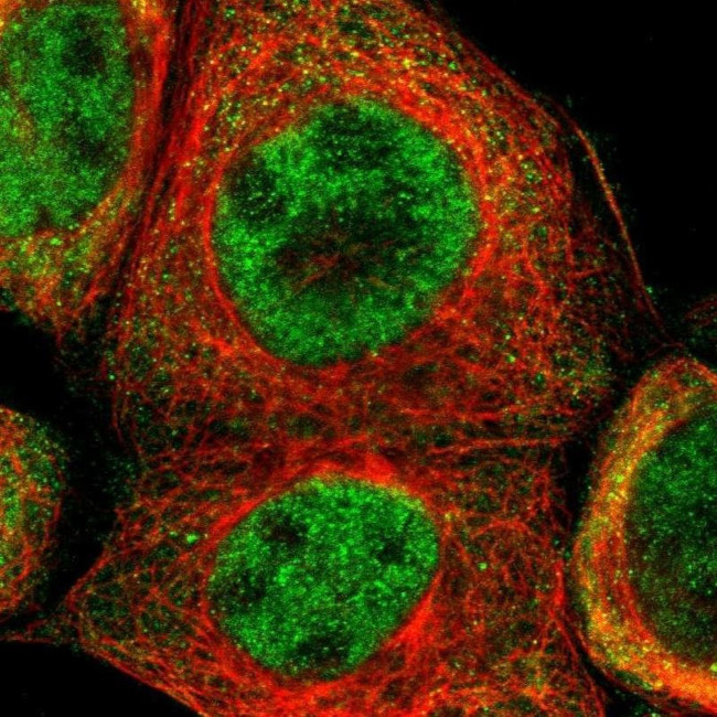 TRIB2 Antibody in Immunocytochemistry (ICC/IF)