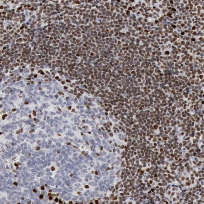 PC4 Antibody in Immunohistochemistry (IHC)