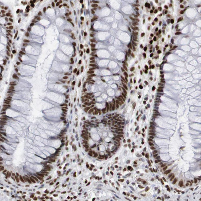 PC4 Antibody in Immunohistochemistry (IHC)