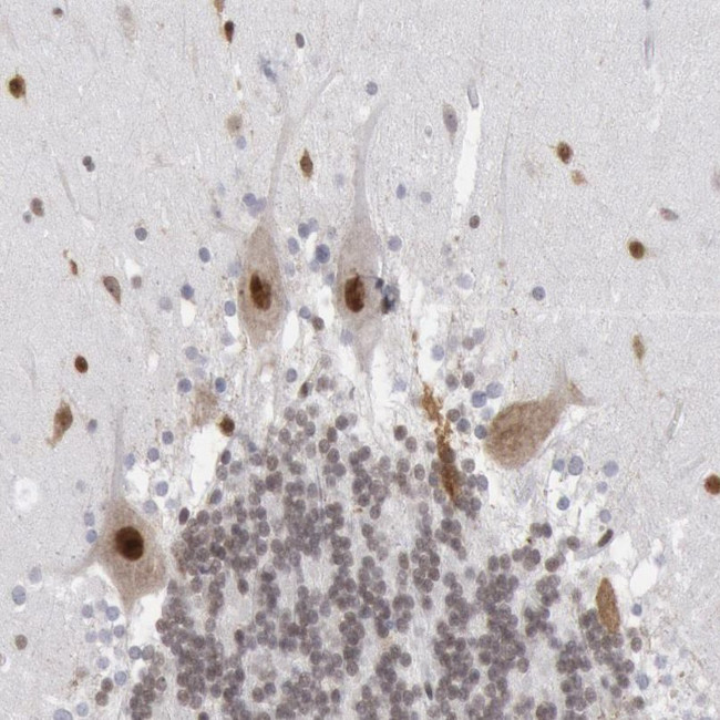 PC4 Antibody in Immunohistochemistry (IHC)