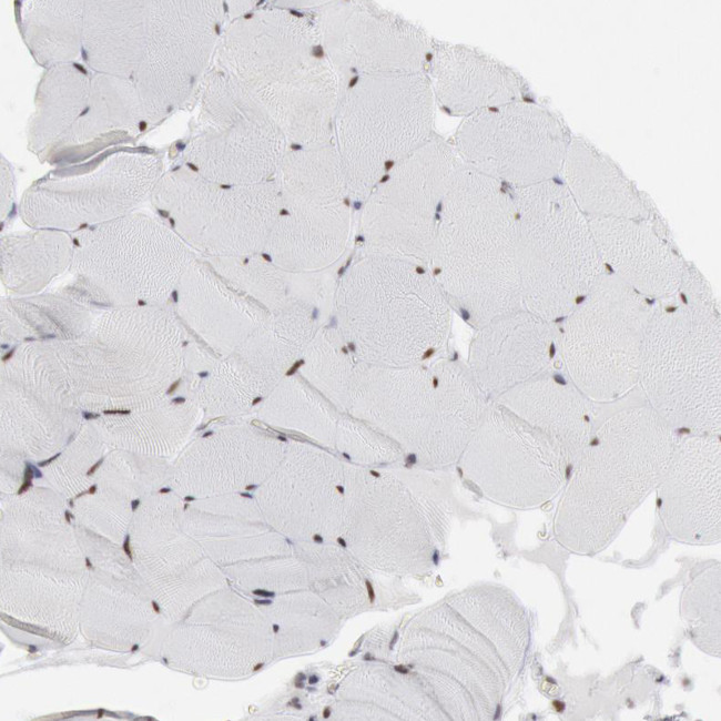 PC4 Antibody in Immunohistochemistry (IHC)