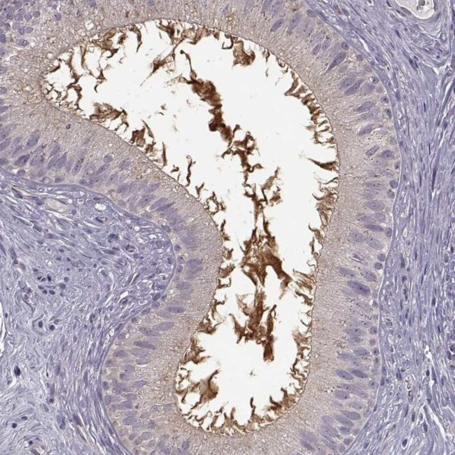 EDDM3B Antibody in Immunohistochemistry (IHC)