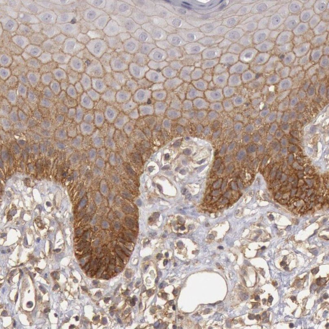 Syntaxin 4 Antibody in Immunohistochemistry (IHC)