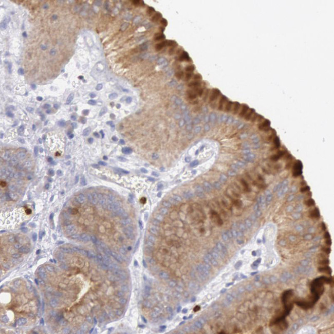 RAB27A Antibody in Immunohistochemistry (IHC)