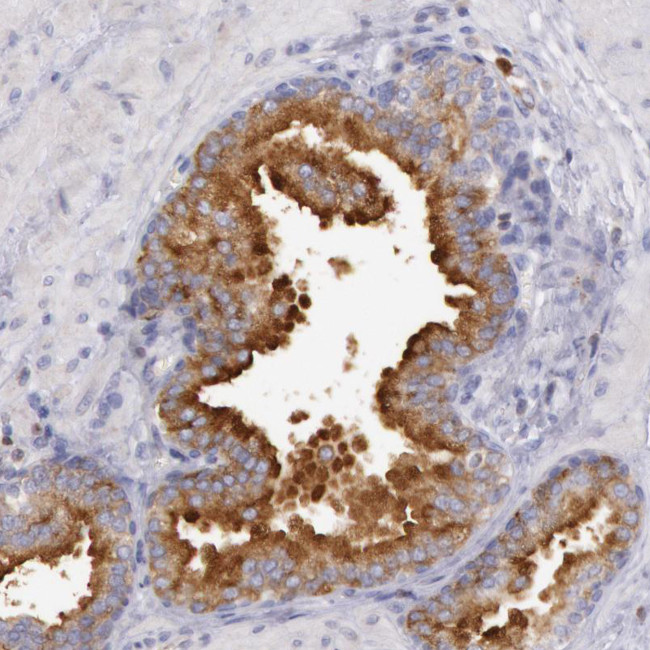 RAB27A Antibody in Immunohistochemistry (IHC)