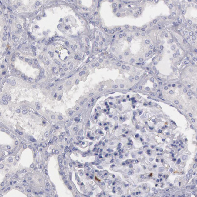 RAB27A Antibody in Immunohistochemistry (IHC)