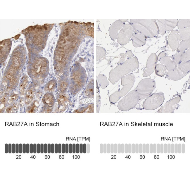 RAB27A Antibody