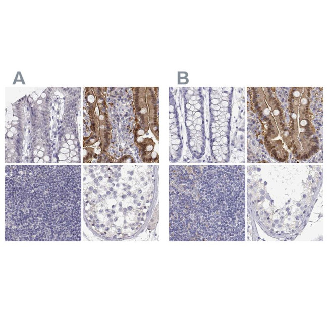 Adenosine Deaminase Antibody in Immunohistochemistry (IHC)