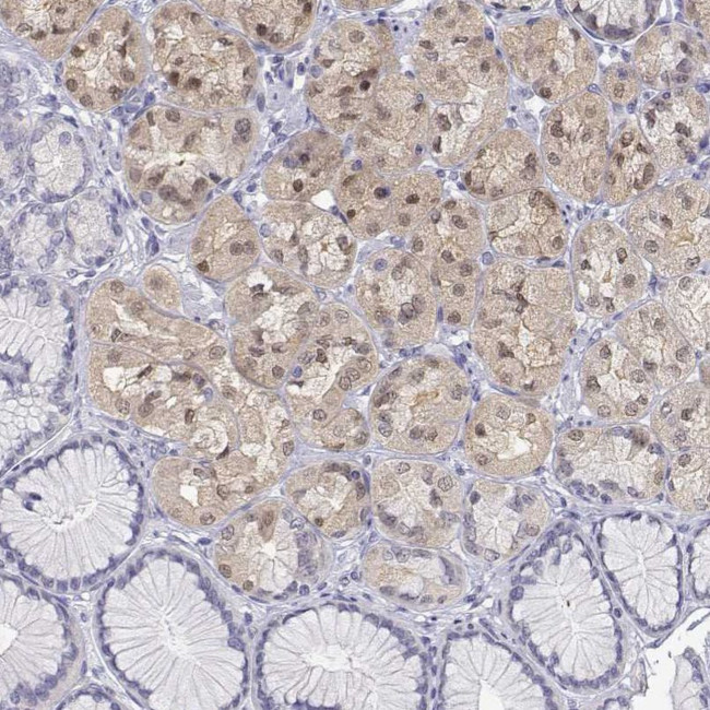 Adenosine Deaminase Antibody in Immunohistochemistry (IHC)