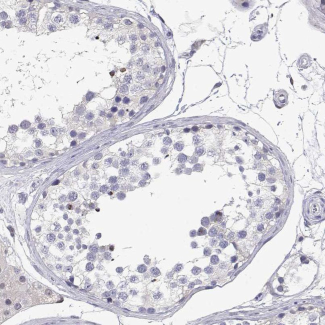 Adenosine Deaminase Antibody in Immunohistochemistry (IHC)