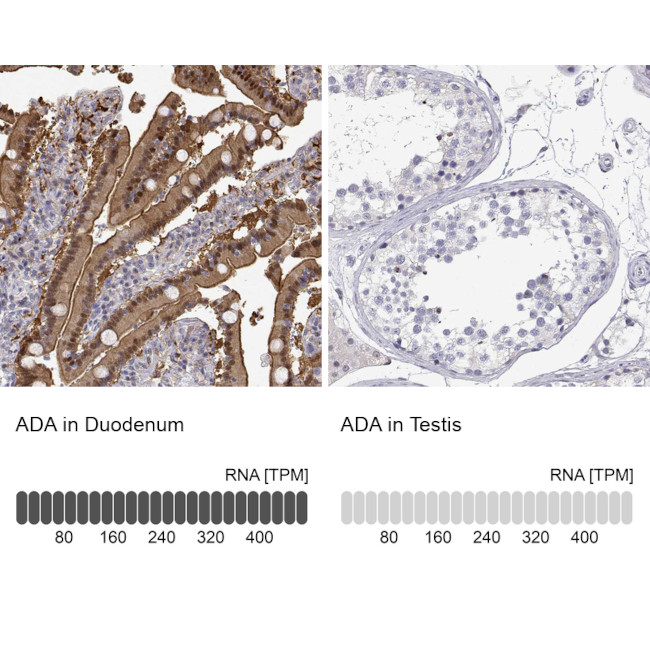 Adenosine Deaminase Antibody