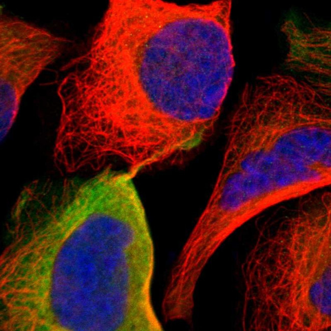 Adenosine Deaminase Antibody in Immunocytochemistry (ICC/IF)