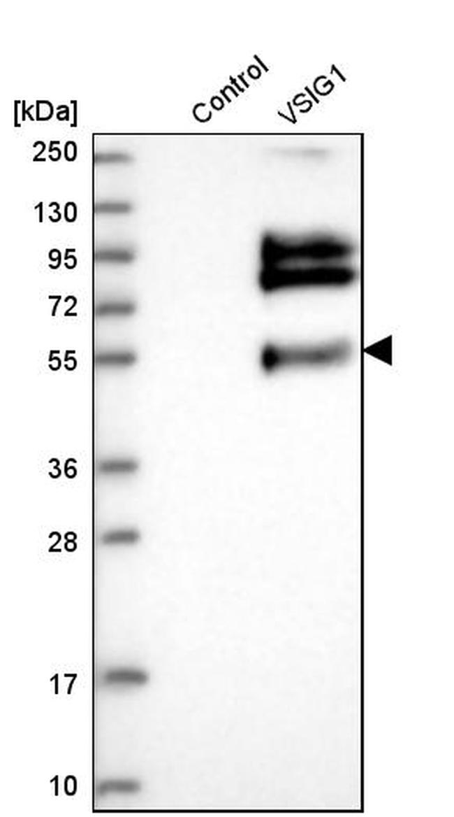 VSIG1 Antibody in Western Blot (WB)