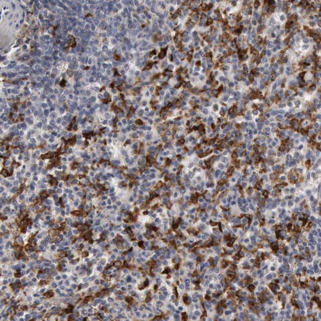 C1QC Antibody in Immunohistochemistry (IHC)