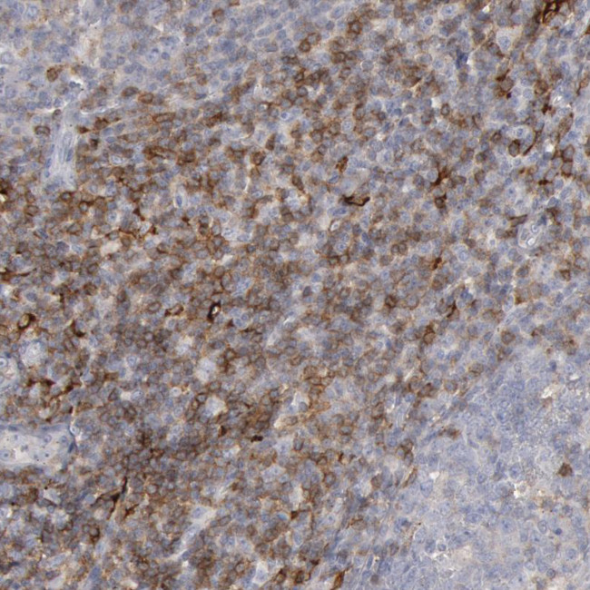 C1QC Antibody in Immunohistochemistry (IHC)