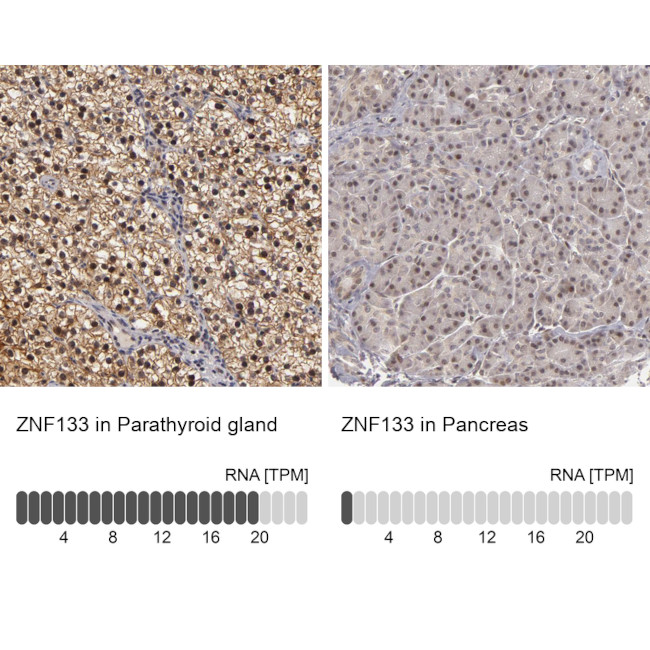 ZNF133 Antibody in Immunohistochemistry (IHC)