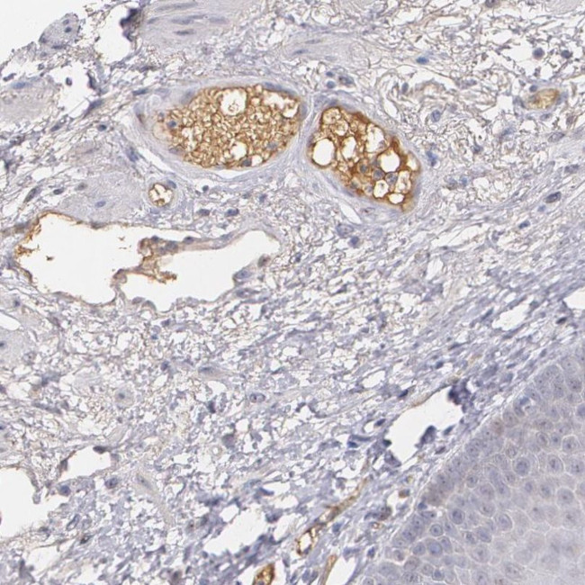 alpha-1 Microglobulin Antibody in Immunohistochemistry (IHC)