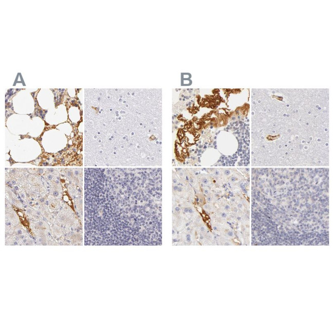 Fetuin A Antibody in Immunohistochemistry (IHC)