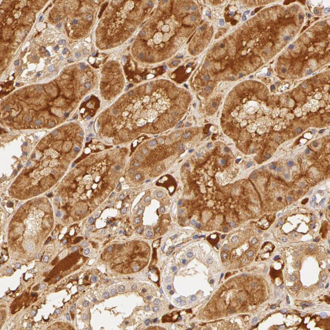 Fetuin A Antibody in Immunohistochemistry (IHC)