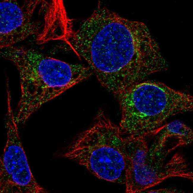 Fetuin A Antibody in Immunocytochemistry (ICC/IF)