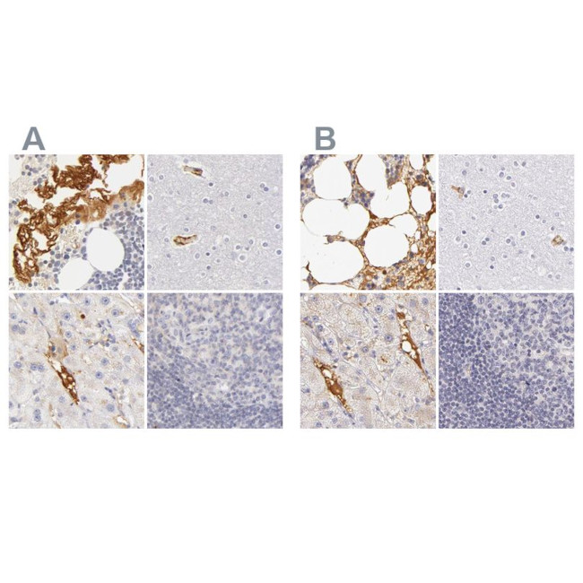 Fetuin A Antibody in Immunohistochemistry (IHC)