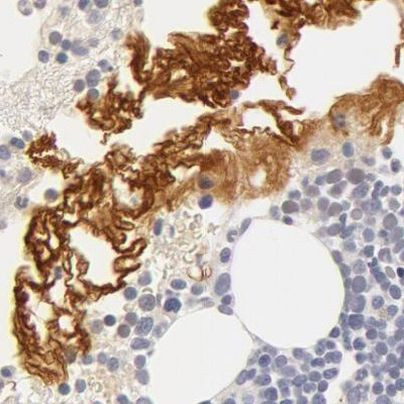 Fetuin A Antibody in Immunohistochemistry (IHC)