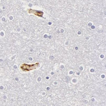 Fetuin A Antibody in Immunohistochemistry (IHC)