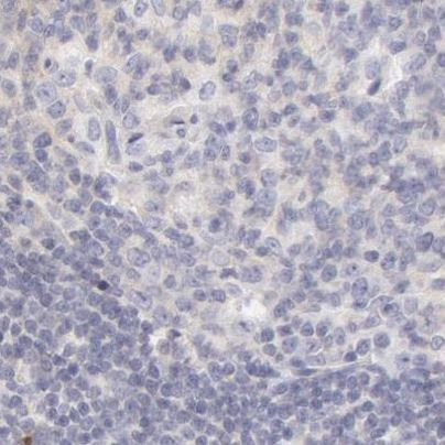 Fetuin A Antibody in Immunohistochemistry (IHC)