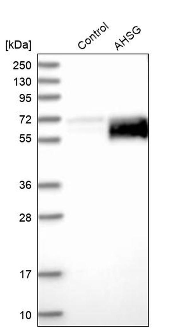 Fetuin A Antibody in Western Blot (WB)